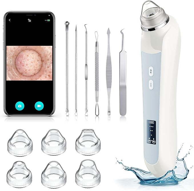 Facial Pore Blackhead Remover Vacuum, 1080P Camera Blackhead Remover, 20x Zoom by Ottleba
