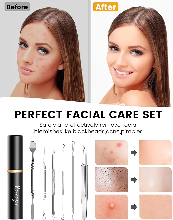 Pimple Popper Tool Kit - Image 6