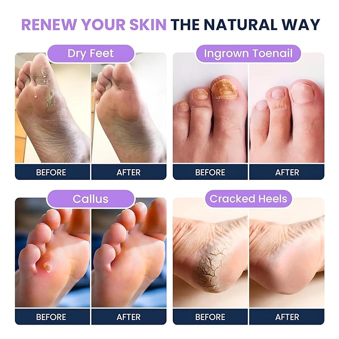 FOOT CURE Soothing Lavender Foot Soak - Image 4