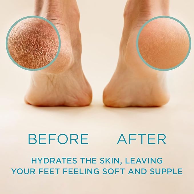 Lee Beauty 8oz Professional Gel Callus Remover - Image 2