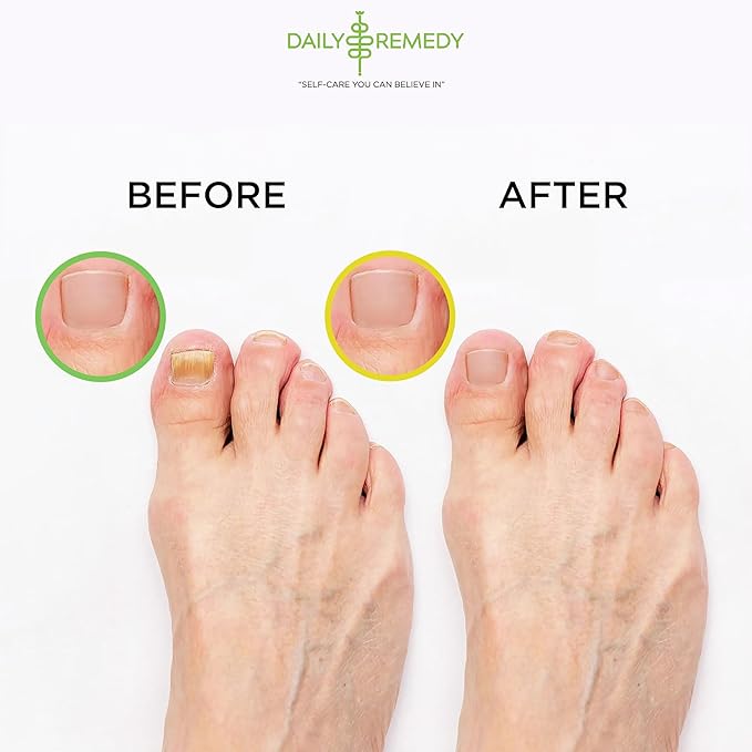 DAILY REMEDY EXTRA STRENGTH Tea Tree Oil & Citrus Detox Foot Soak Set - Image 6