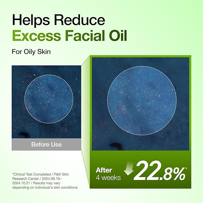 Anua Azelaic Acid 10 Hyaluron Redness Soothing Serum, Facial Serum - Image 6