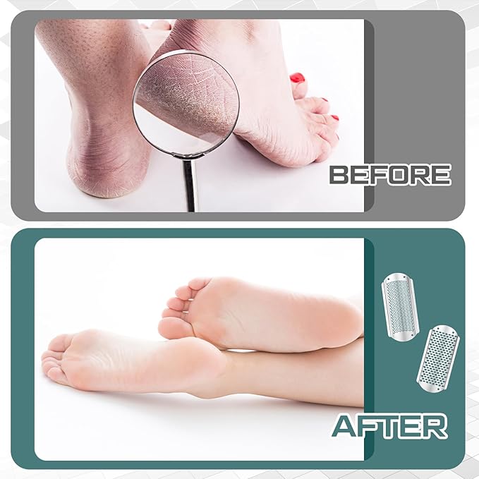 Moxweyeni 8 Pack Silver Foot File Callus Remover Replacement Blades Metal File - Image 4