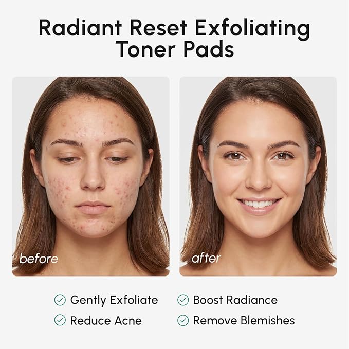 MAREE Glycolic Acid Resurfacing Pads - Image 5
