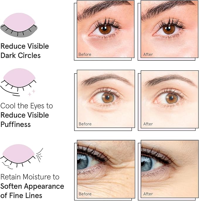 grace & stella Award Winning Under Eye Mask Reduce Dark Circles, Puffy Eyes - Image 8