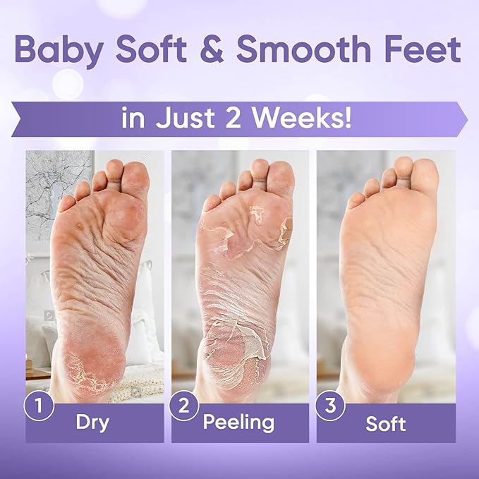CÉLOR Foot Peeling Mask for Dry Cracked Feet | Foot Mask to Exfoliate Rough - Image 2
