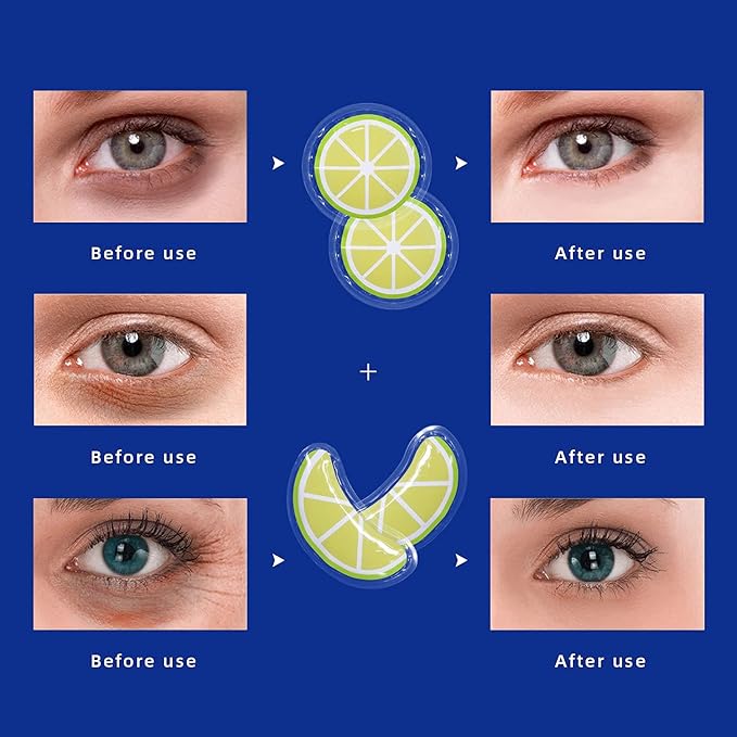 ZNÖCUETÖD Gel Ice Pack Reusable Cooling Eye Pads and Under Eye Patches - Image 7