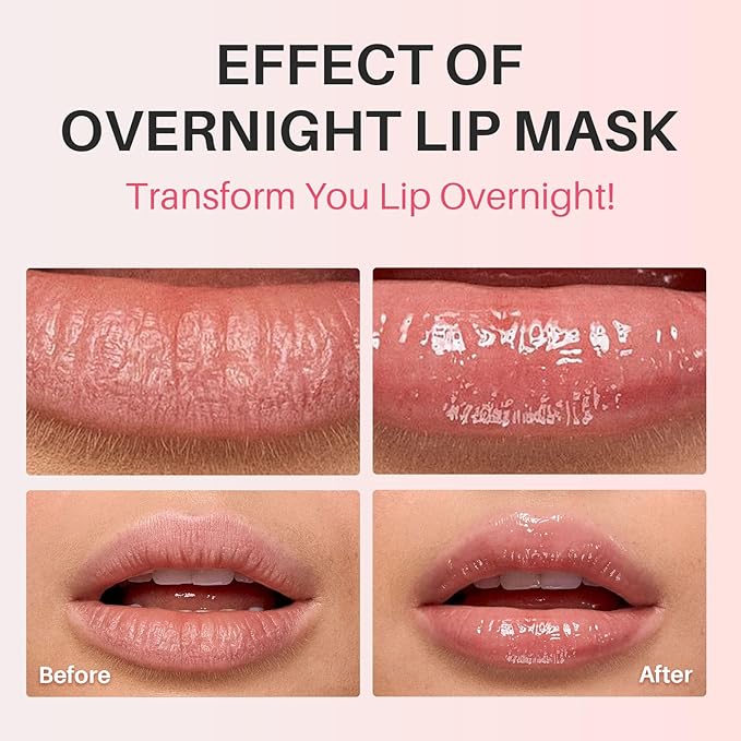 SPODARE Lemon Lip Mask, Hydrating Overnight Lip Sleeping Mask, Lip Moisturizer - Image 5