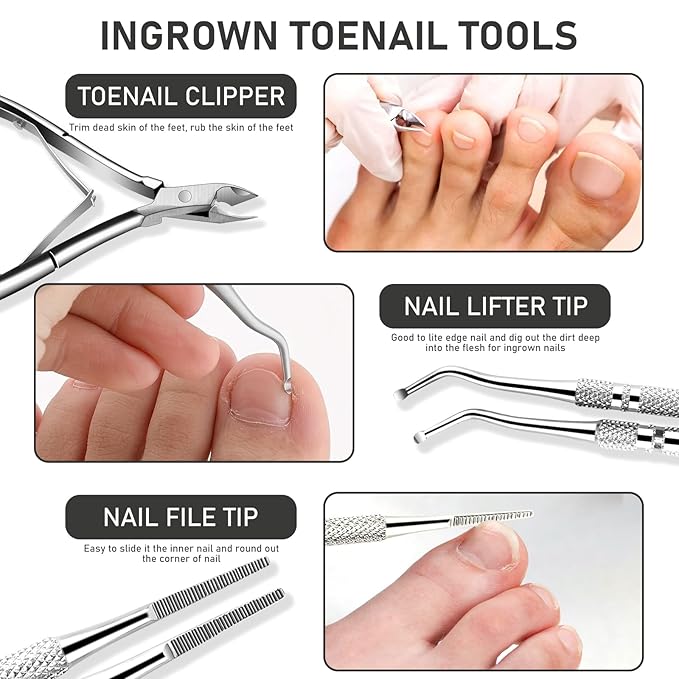 Ingrown Toenail Tool Kit, Ingrown Toenail Removal Kit: Ingrown Toenail Clippers - Image 3
