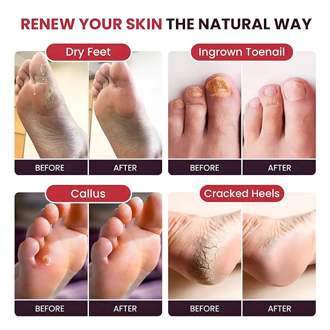 FOOT CURE Foot Soak with Epsom Salts – All-Natural Blend - Image 4