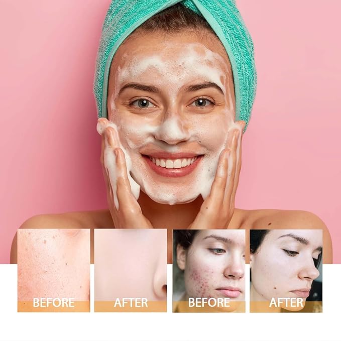 2 Pcs Turmeric Facial Cleanser, Glow Wash Turmeric Face Wash - Image 5