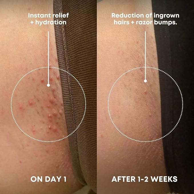 Bushbalm Ingrown Hair Exfoliating Scrub - Image 2