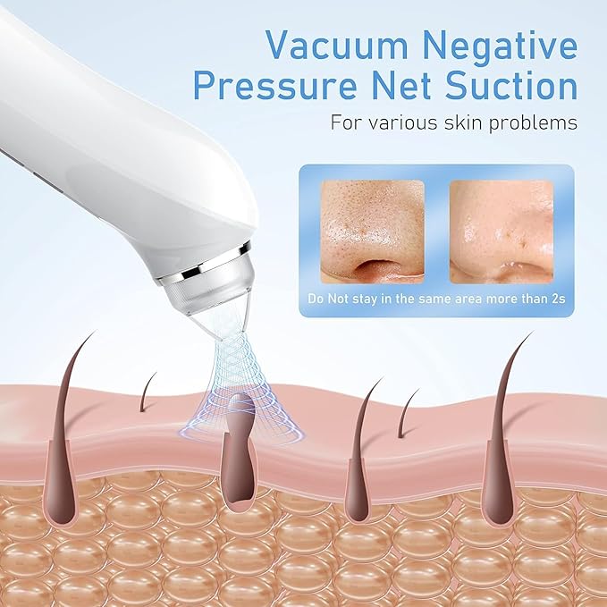 Blackhead Remover Vacuum, USB Interface Type Pore Vacuum, Men and Women Pore - Image 3