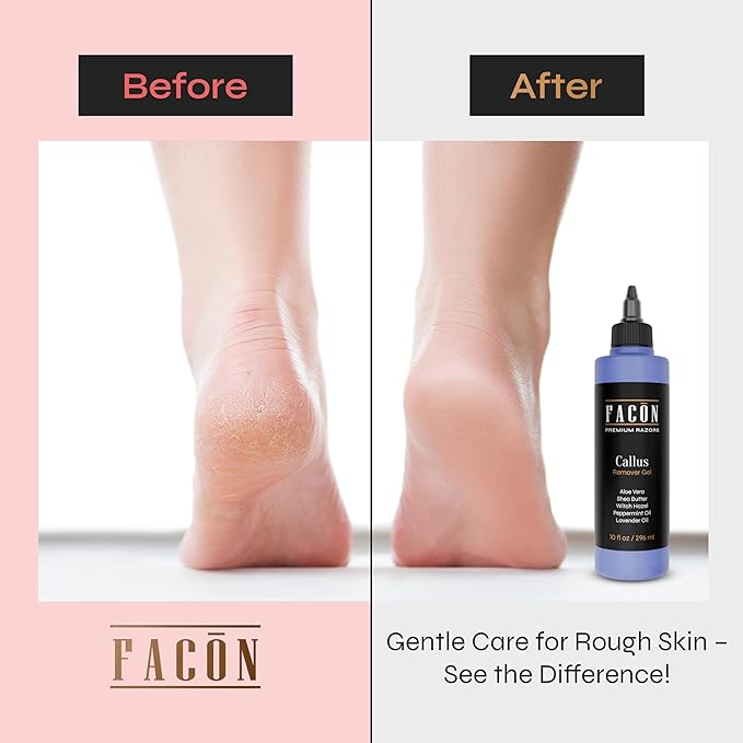 Facón Professional Callus Remover Gel - Image 3
