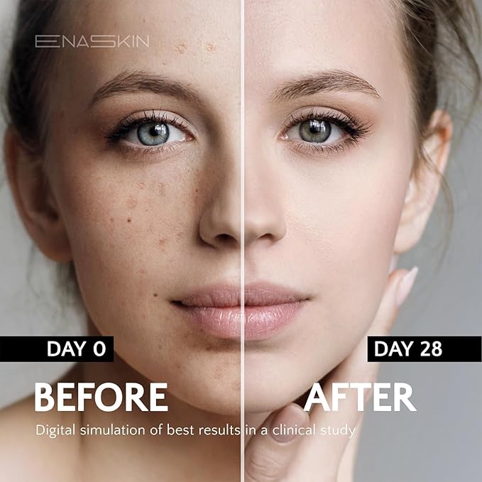 Enaskin Dark Spot Set - Image 5