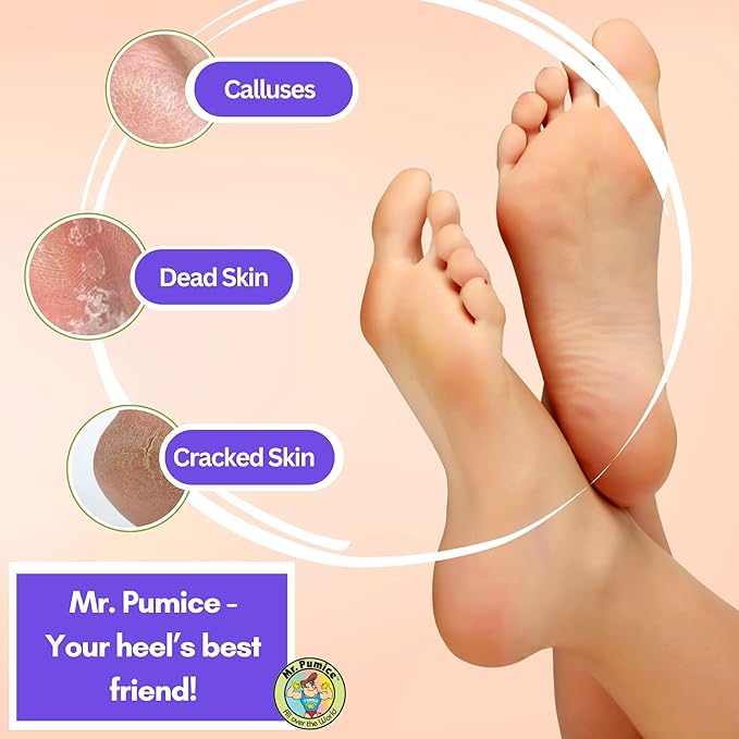 Mr. Pumice Ultimate PUMI Bar 2-in-1 Dual Grit Callus Remover, Pedicure Stone & - Image 5