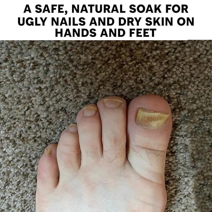 Long Creek Herbs Nail Soak - Image 6