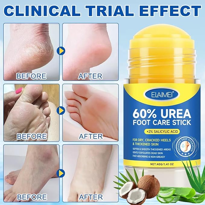 60% Urea Cream Stick plus 2% Salicylic Acid, Maximum Strength Urea Foot Cream - Image 6