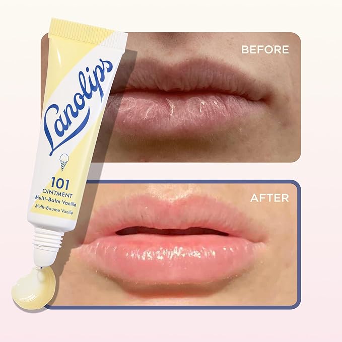 Lanolin 101 Multipurpose Ointment - Image 5