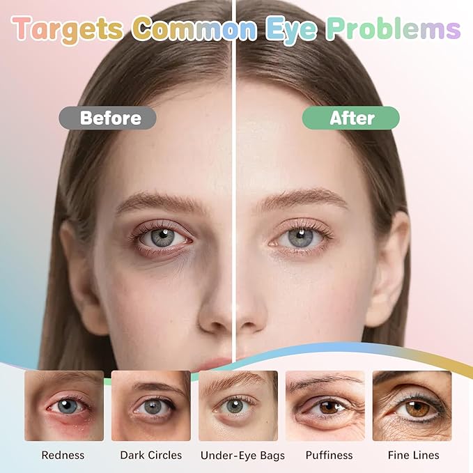 120 Pairs Under Eye Patches for Puffy Eyes and Dark Circles - Image 7