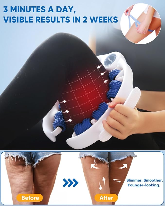 ONUEMP Cellulite Massage Tool, Lymphatic Drainage Cellulite Remover - Image 3