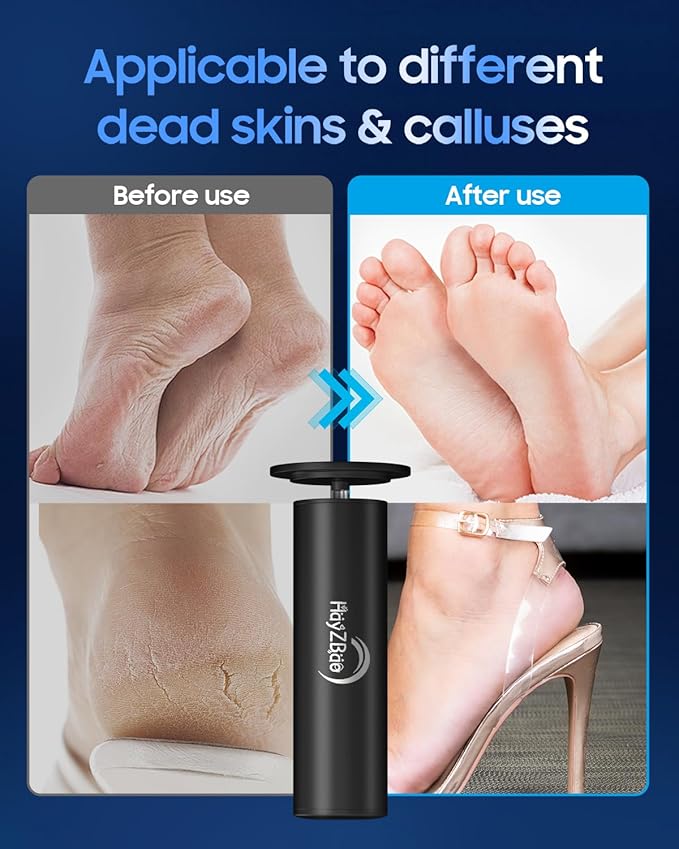 FSA&HSA Electronic Foot File, Callus Remover - Image 2
