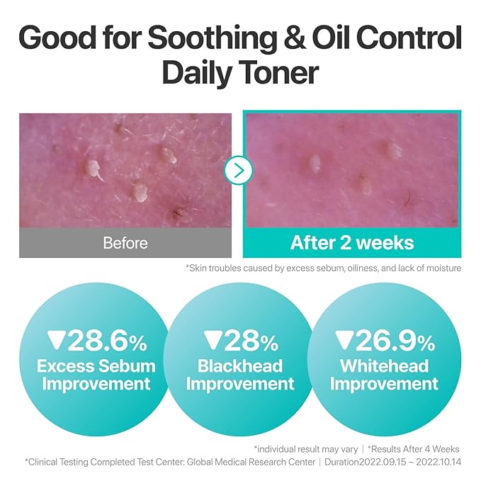 numbuzin No.1 Toner | Pure-Full Calming Herb Toner | Breakouts, Excess Oil - Image 3