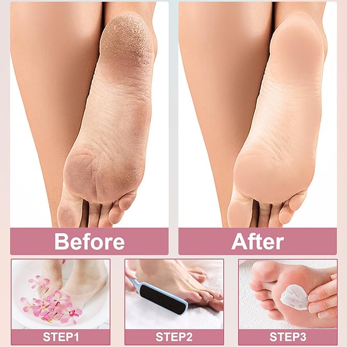 36 Pieces Flat Shaped Foot File Foot Callus Remover - Image 3