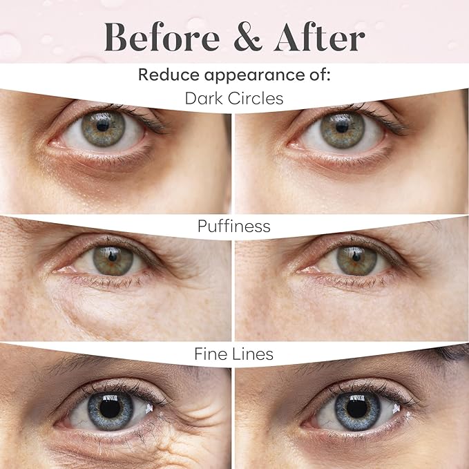 AURAE Rose Under Eye Patches - Image 4