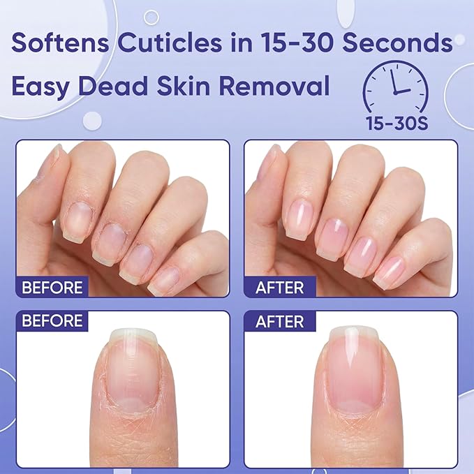 Ceramic Cuticle Pusher & Oil Pen + Cuticle Remover Gel – Gentle Nail Care Kit - Image 2