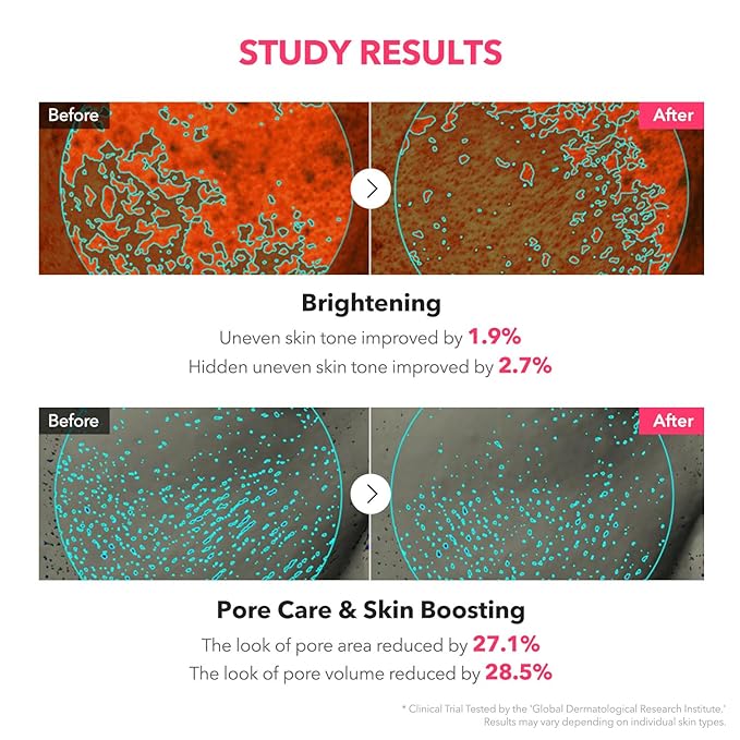 APRILSKIN TXA Niacinamide Toning Shot 99 Spicule Facial Serum｜Skin Booster Serum - Image 5