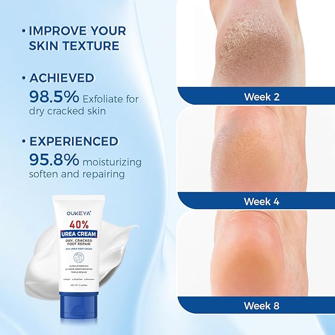OUKEYA Urea Cream 40 Percent Tube, Urea Cream 40 Percent - Image 6