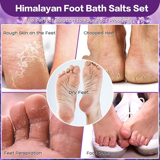 Tea Tree Oil Foot Soak Stubborn Foot Odor, Athletes Lavender Foot Soak - Image 5
