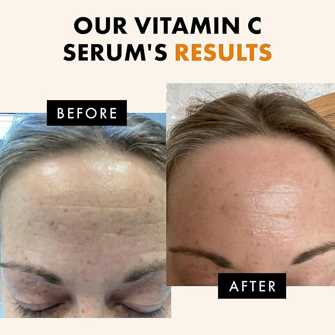 Eclat Skincare Vitamin C Serum - Image 4
