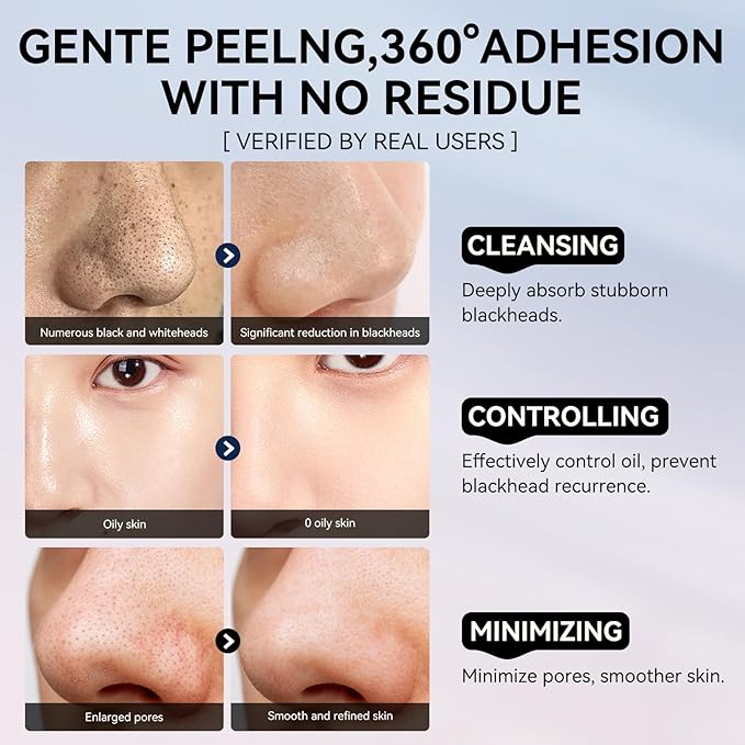 LANBENA 3-in-1 Blackhead Removal Set - Image 7