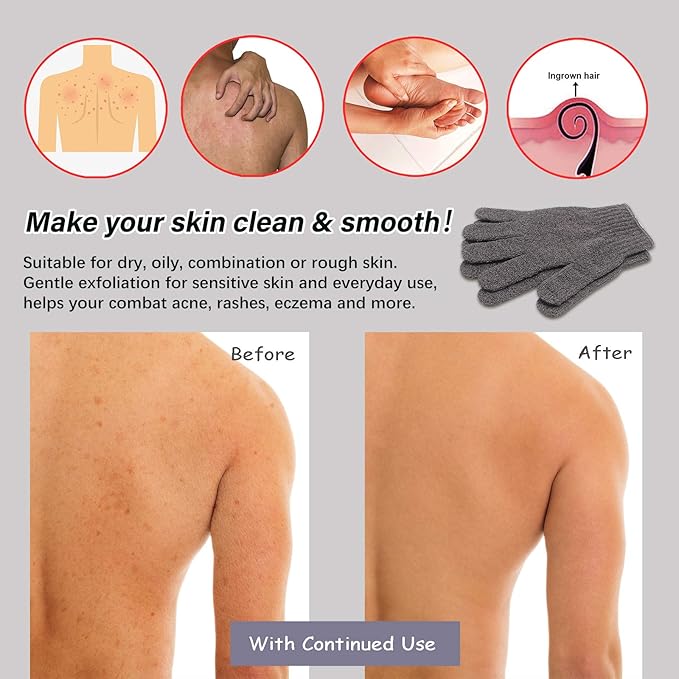 MIG4U Shower Exfoliating Scrub Gloves, Bathing Gloves Body Wash Dead Skin - Image 3