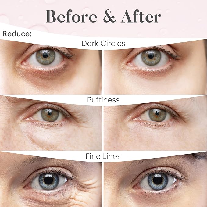 BLOOMORA Rose Under Eye Patches - Image 4