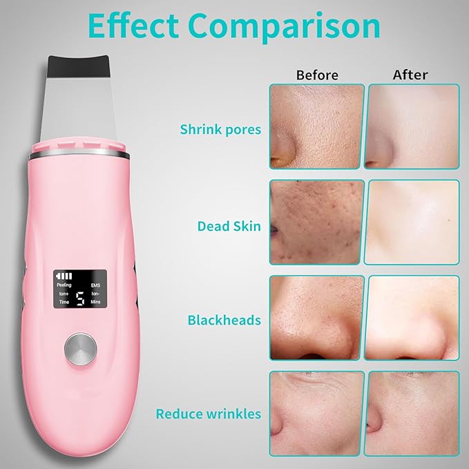 Face Scrubber Skin Spatula - Image 3