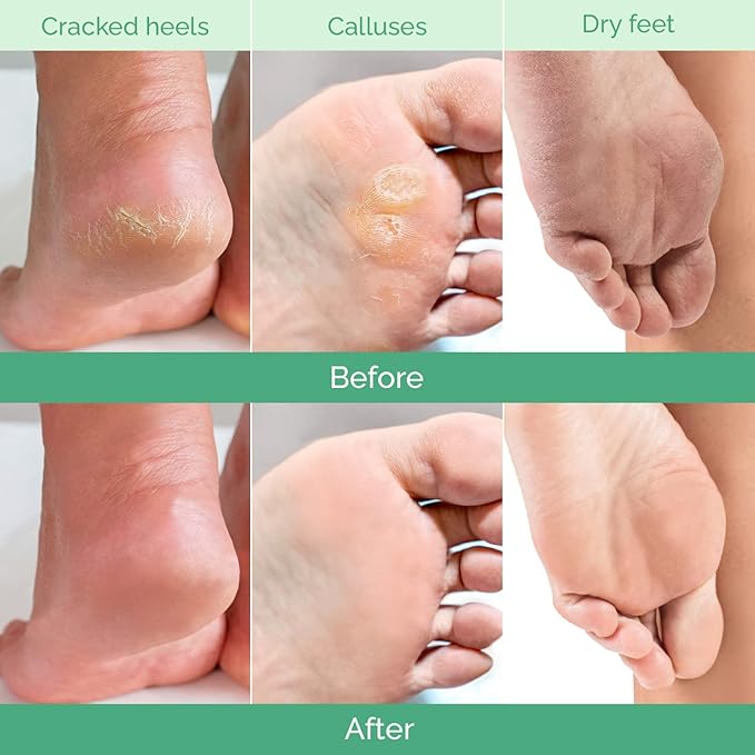 PLANTIFIQUE Foot Peeling Mask - Image 3