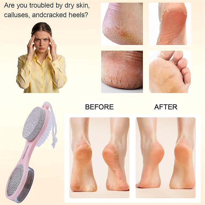 Foot Scrubber Brush with Pumice Stone - Image 3
