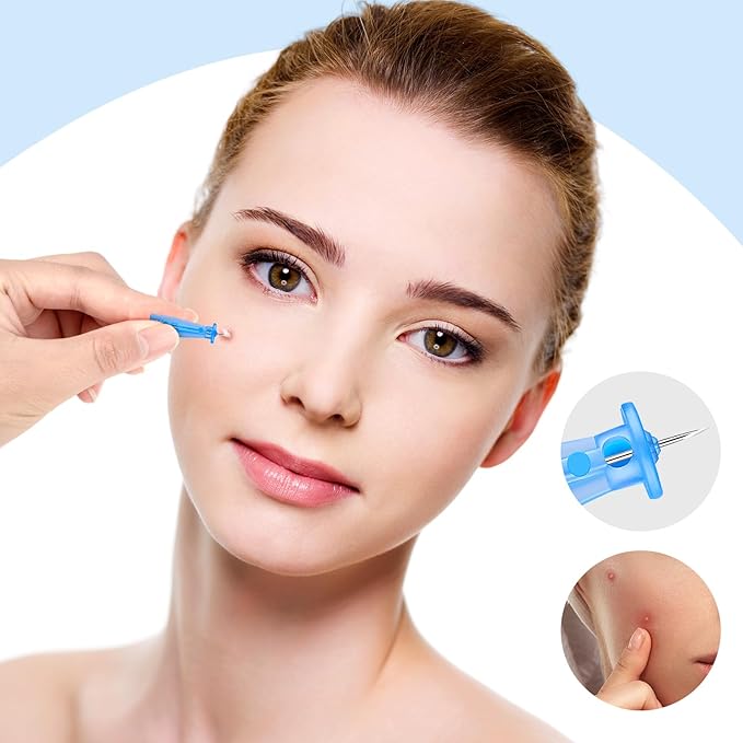 Lancets for Facial Extraction - Image 6