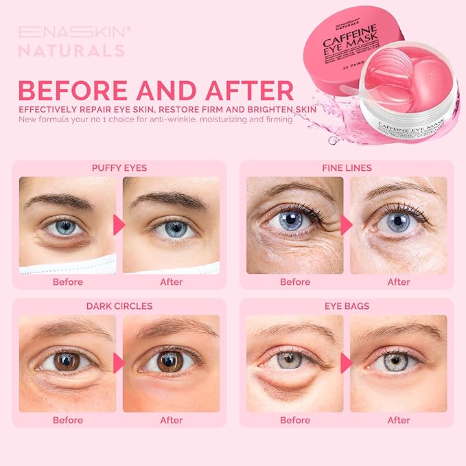 Under Eye Patches for Dark Circles: Caffeine Gel Masks for Puffiness Undereye - Image 2