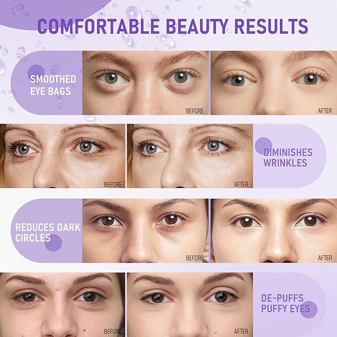 Eye Mask - 30 Pairs Retinol Under Eye Patches Skin Care Products, Eye Masks - Image 5