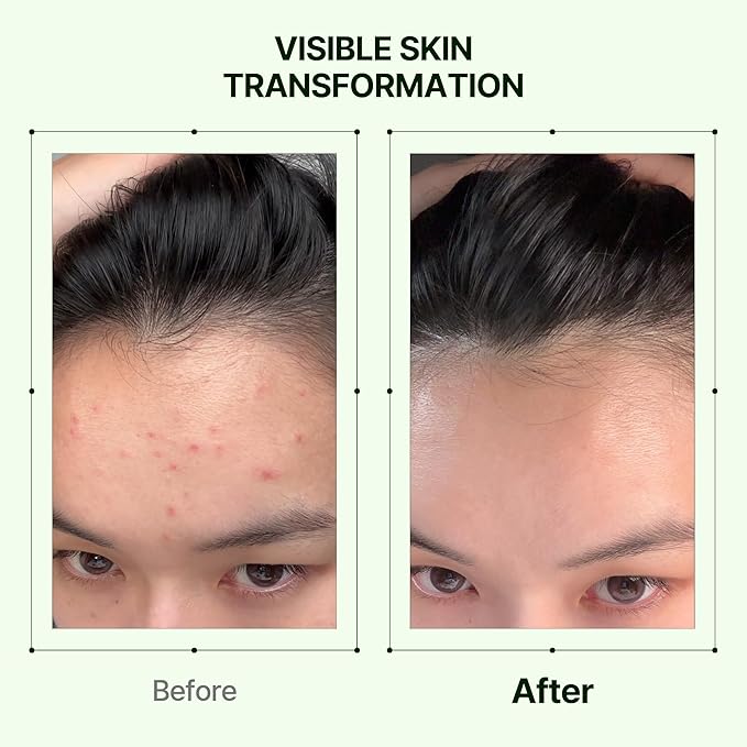 Orien Mugwort Zero Film Toner 5.41 fl.oz. 160ml ㅣpH5.5 Calming, Hydrating Spray - Image 6