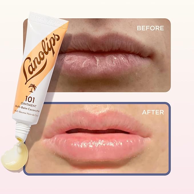 Lanolin 101 Multipurpose Ointment - Image 5
