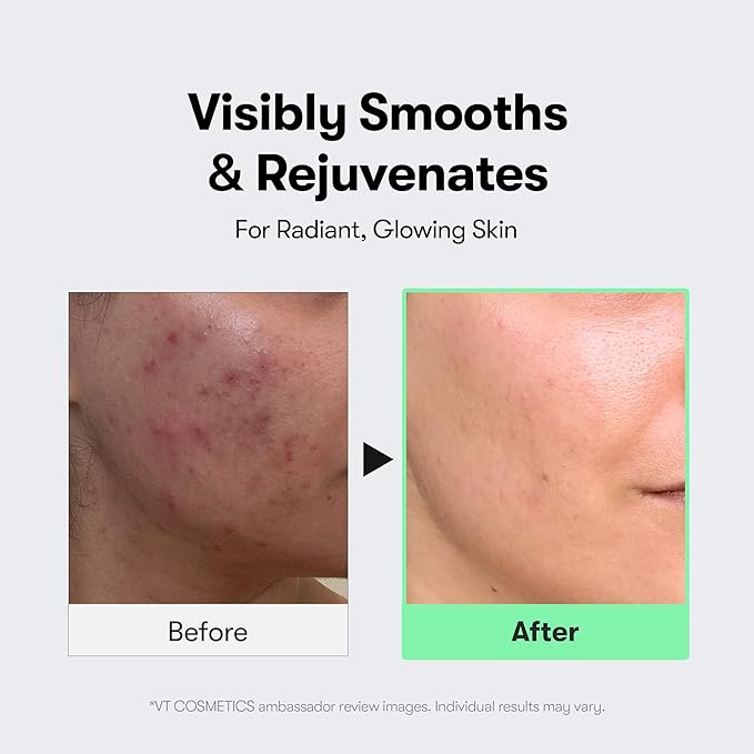 VT COSMETICS CICA Reedle Shot 50, Spicule Microneedling Serum - Image 5