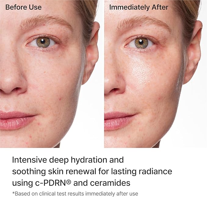 REJURAN® Turnover Mask, c-PDRN® – Original Salmon DNA - Image 4