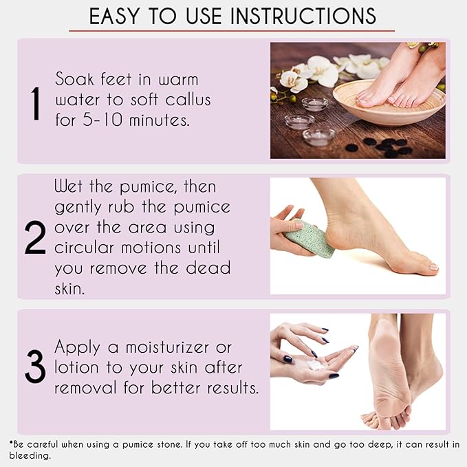 Karlash Professional Pedicure Foot Pumice Stone - Image 6