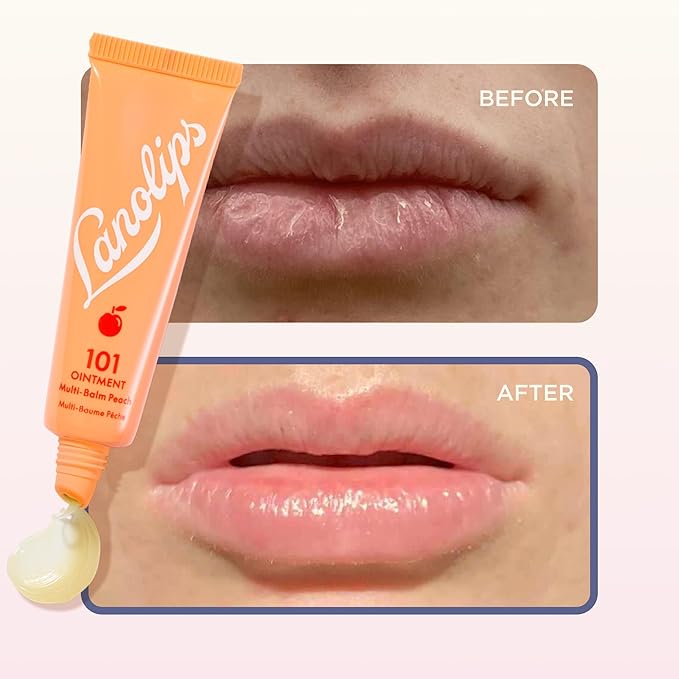 Lanolips 101 Ointment - Image 5
