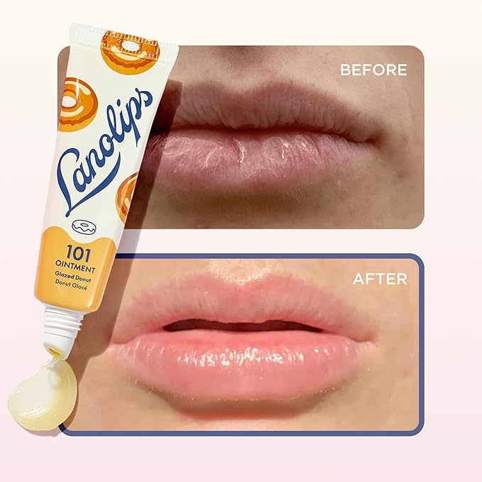 Lanolin 101 Multipurpose Ointment - Image 5